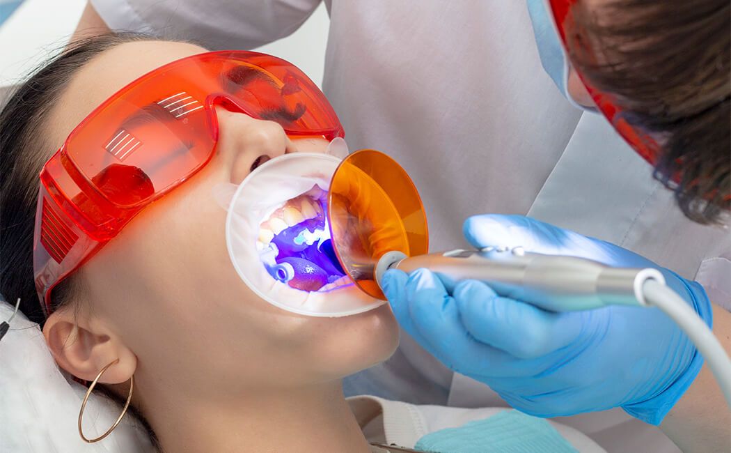 Teeth Whitening at Churchill Glen Dental, Mississauga